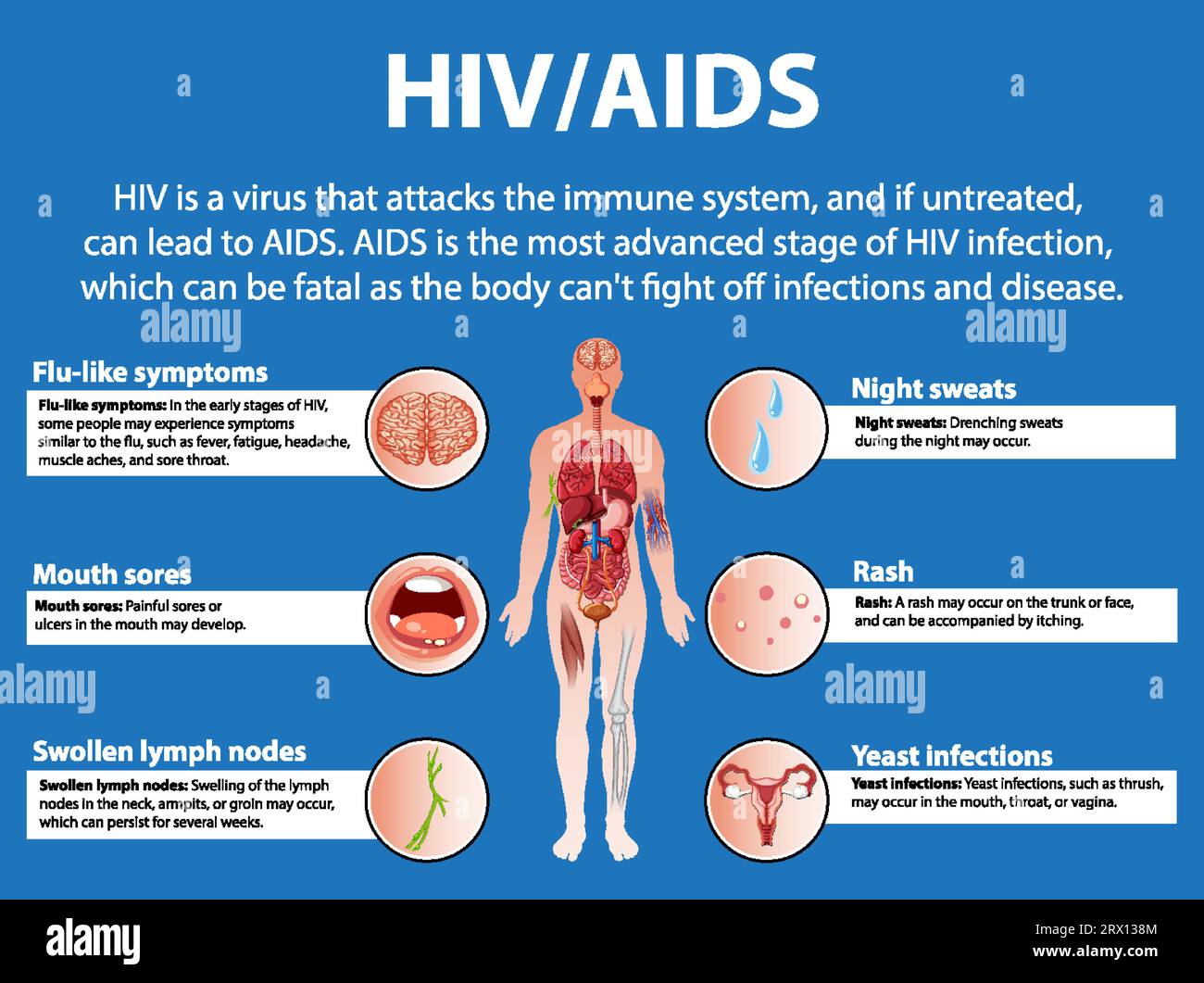 Aids Life Cycle