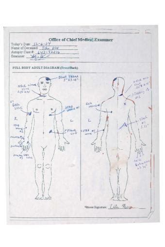 Eddie Long Autopsy Report Explained