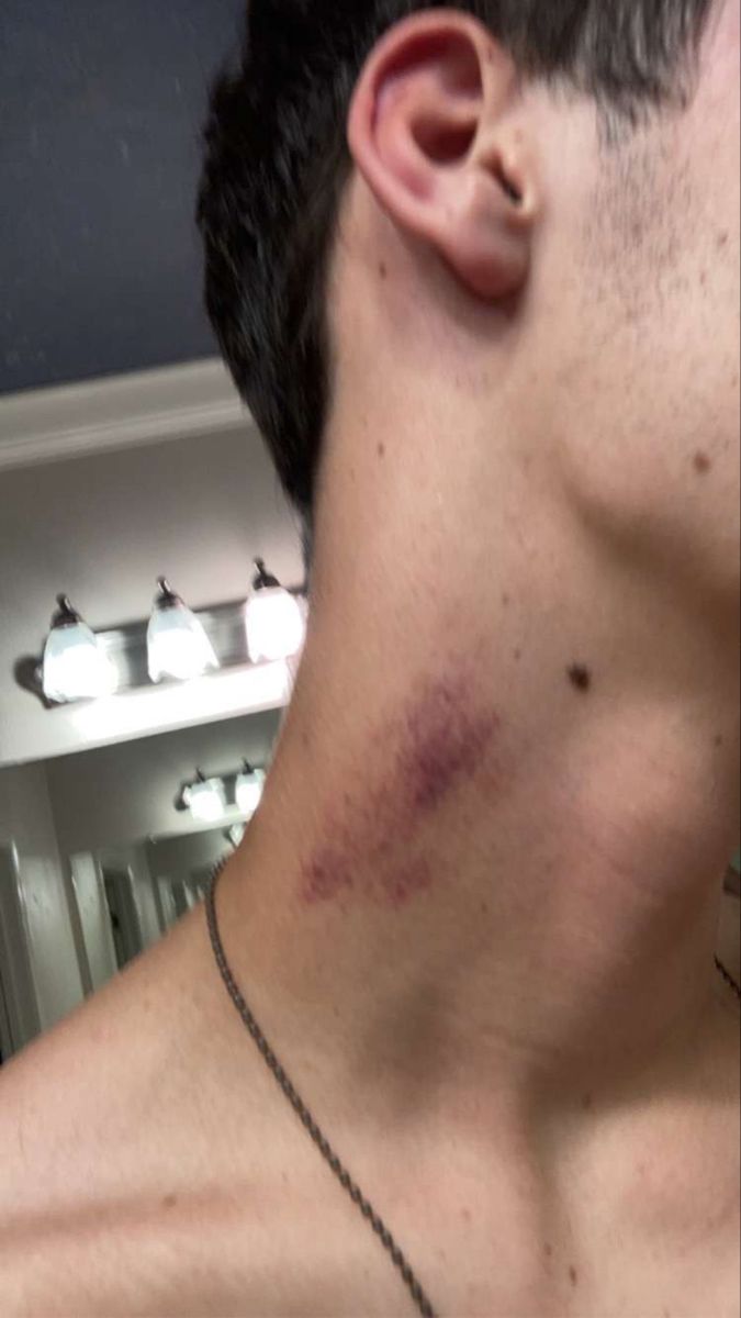 Hickey Secrets: Give Perfect Kisses