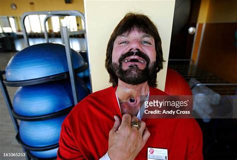 Steve Dr Death Williams: Expert Insights & Cases